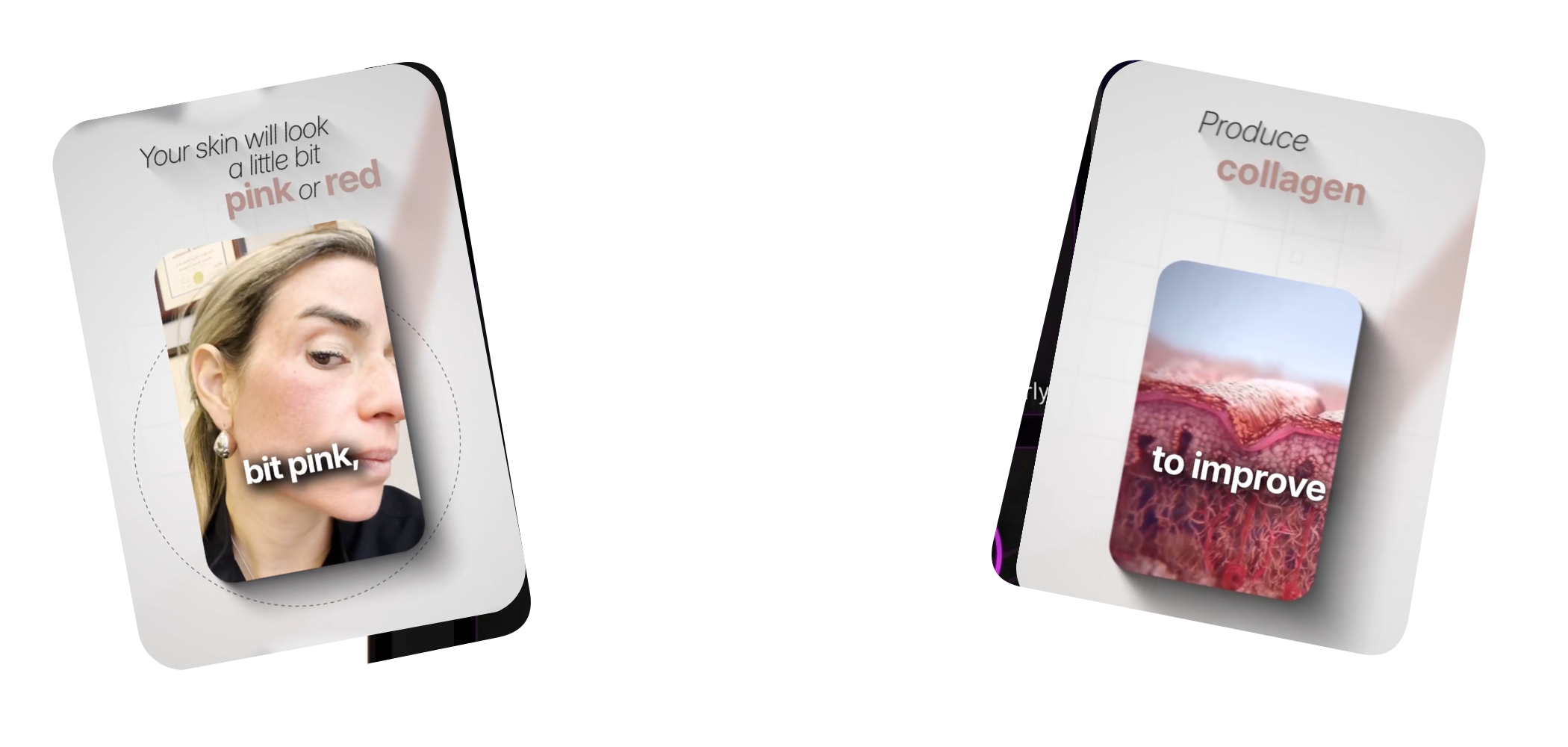 Patient education cards describing expected redness and collagen production after treatment